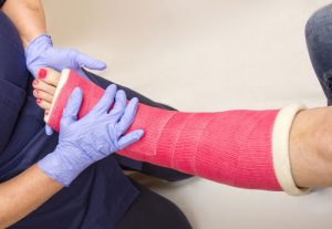 I have a splint or cast. What do I need to know about it?