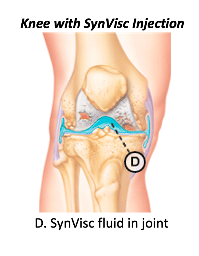 Knee_injury2 Knee_injury2